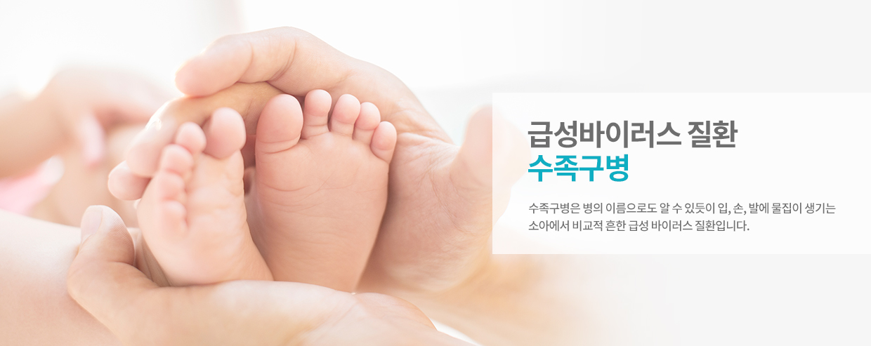 급성바이러스 질환 수족구병